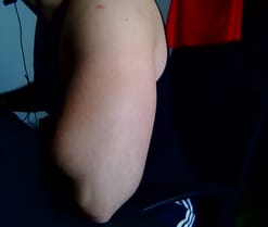 trencoxx