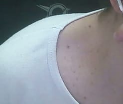 amateur19792