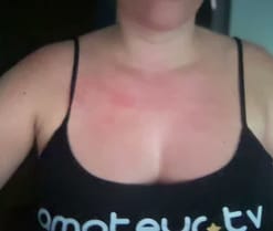 Potorras